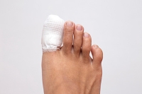Reasons for a Fractured Toe