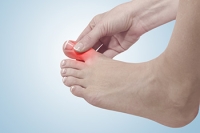 Bunions Versus Gout and How the Big Toe Is Affected