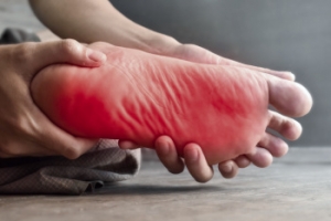 Common Symptoms of Neuropathy in the Feet